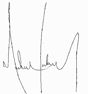 Signature of Michael Jackson, Pop Music Star